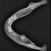 Mandible radiograph